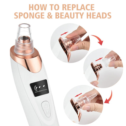 Electric Blackhead Remover Vacuum