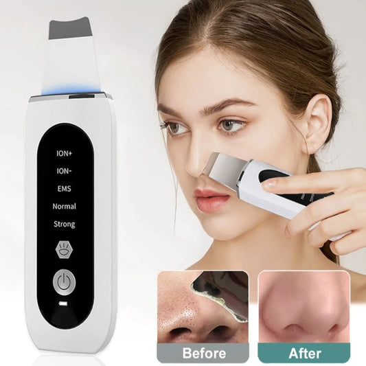 Ultrasonic Face Skin Scrubber